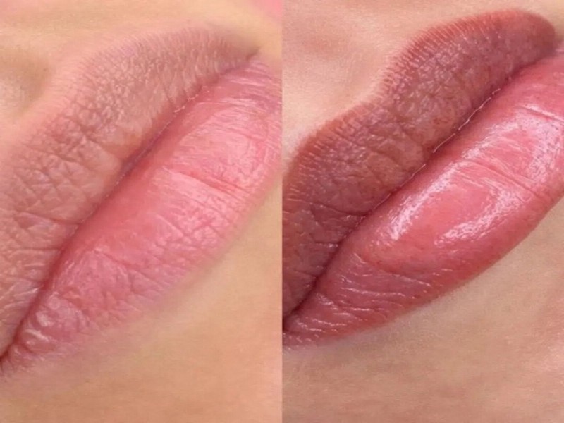 MicroLabios-800x600-03