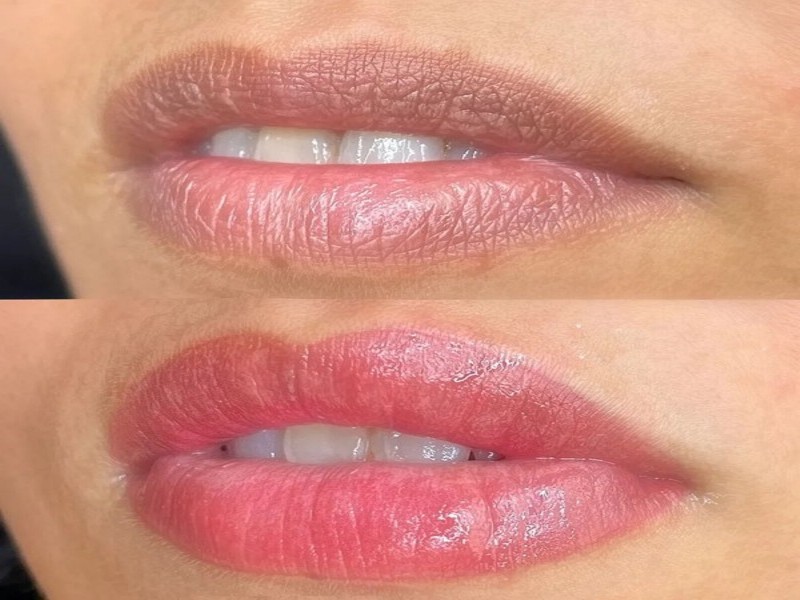 MicroLabios-800x600-05
